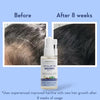 Anagrow Hair Growth Serum image 3
