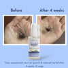 Anagrow Hair Growth Serum image 4