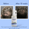 Anagrow Hair Growth Serum image 7